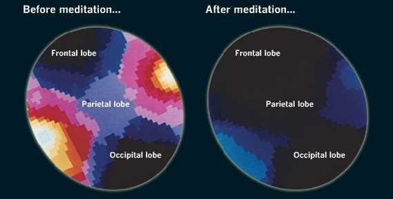 Benefícios da Meditação para o Bem-Estar Emocional